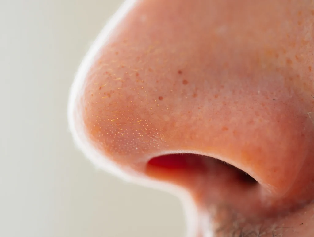 Dehydration and ENT Mucous Membranes: Breathing and Performance Impact