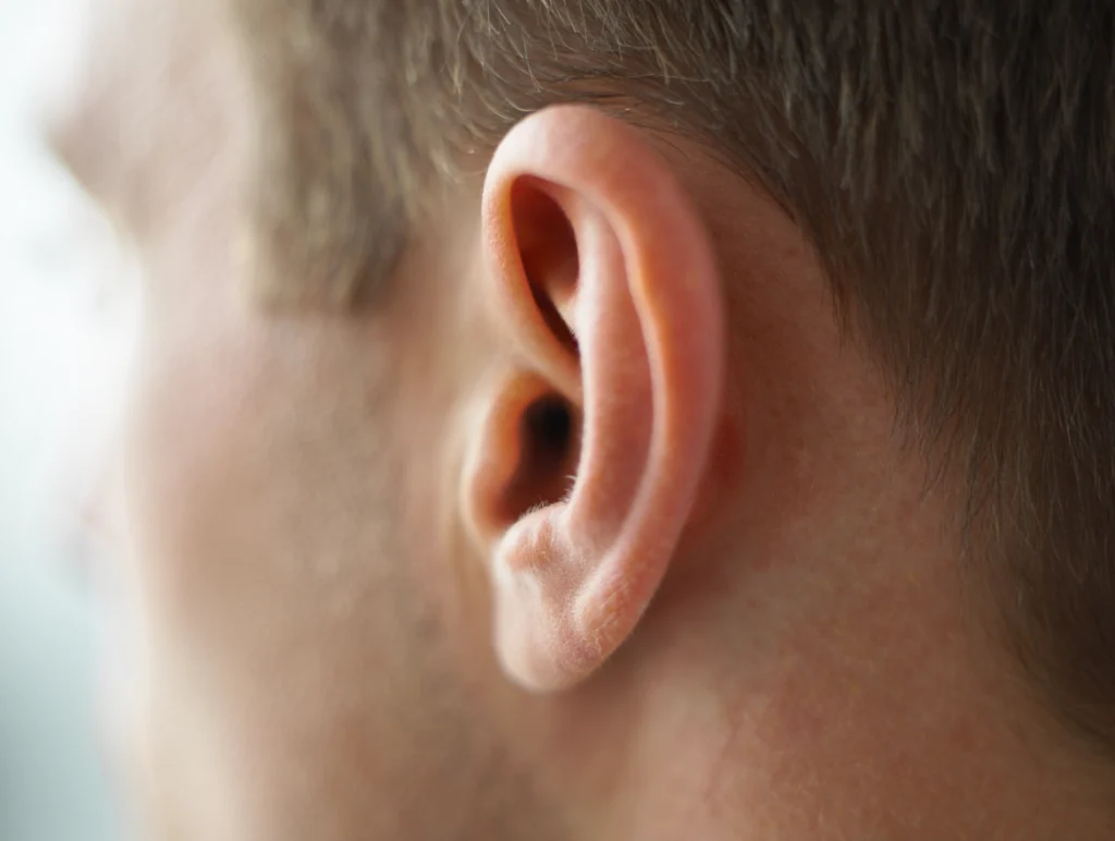 Traumatic Auricle Injuries in Martial Arts: Causes, Dx, Tx, Prevention